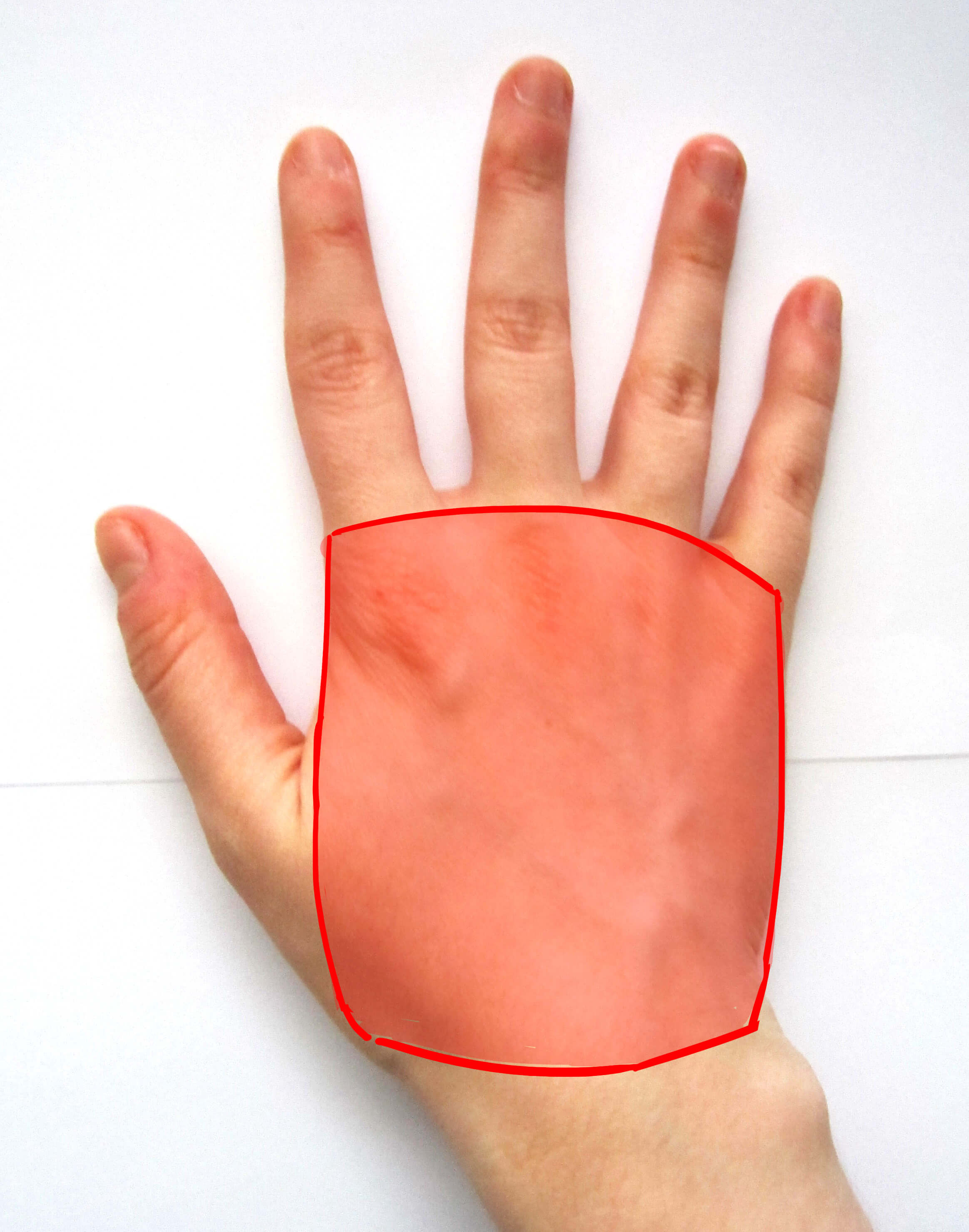 Palma de la mano de espaldas