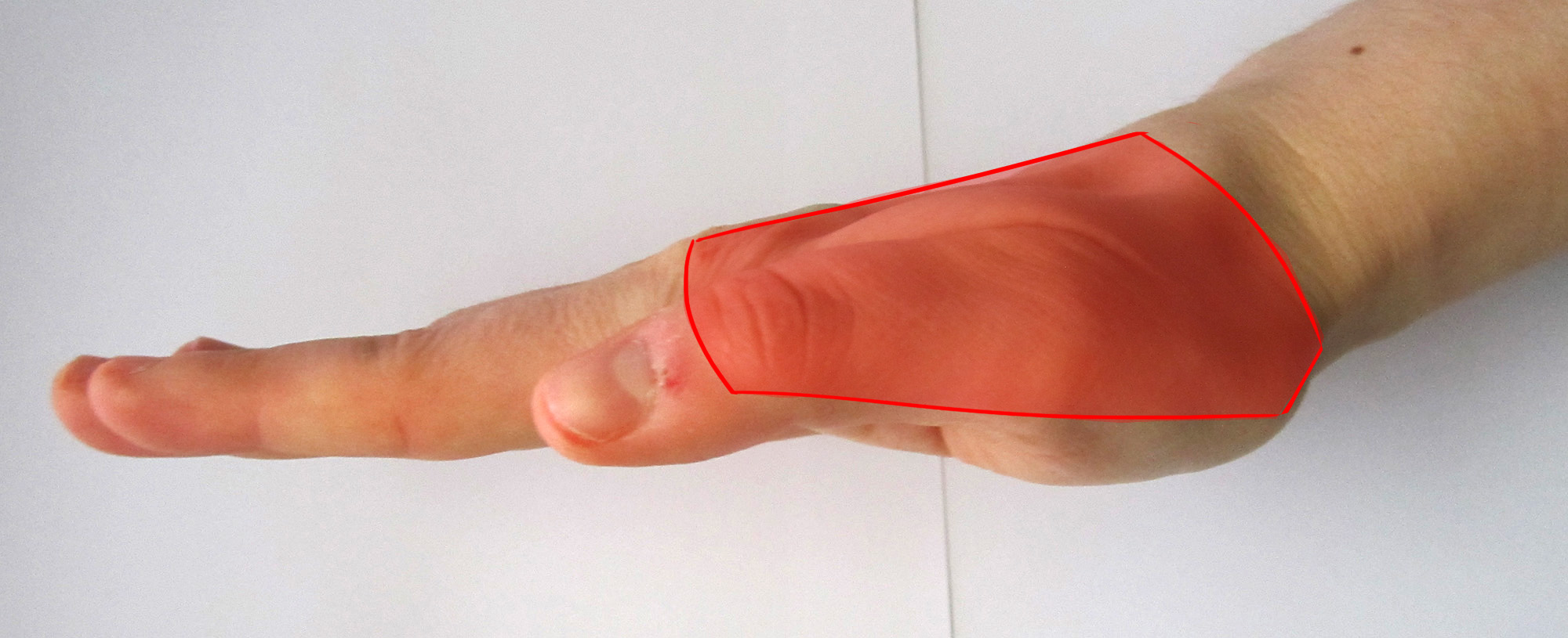 Perfil de la palma de la mano