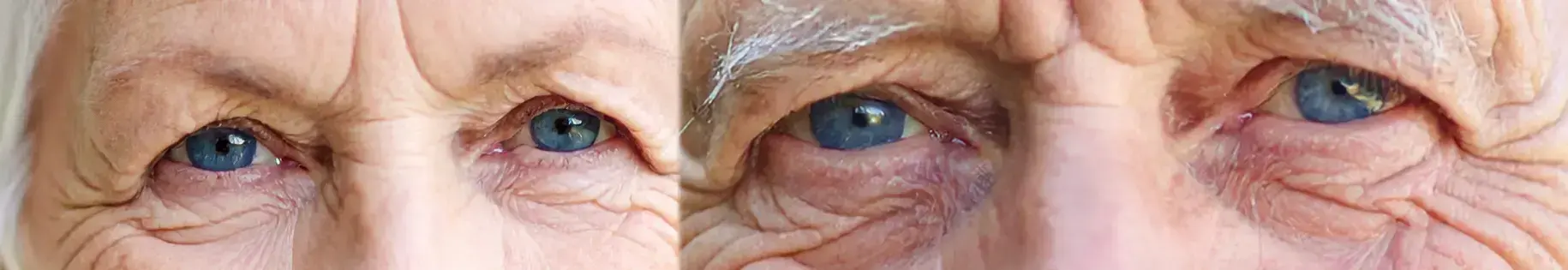 images montrant les regards de deux personnes âgées