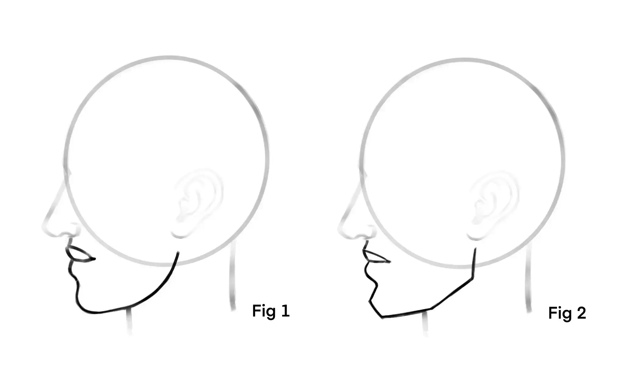 diferrences between a female profile and a male profile